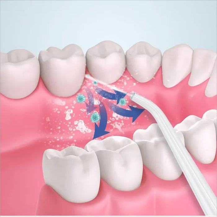 DLC - Portable Oral Irrigator